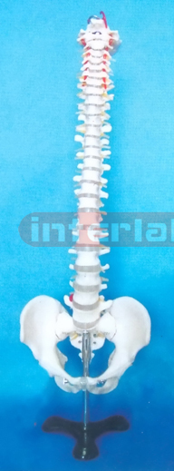 GIANT RIGID VERTEBRAL  COLUMN WITH PEVLlS.